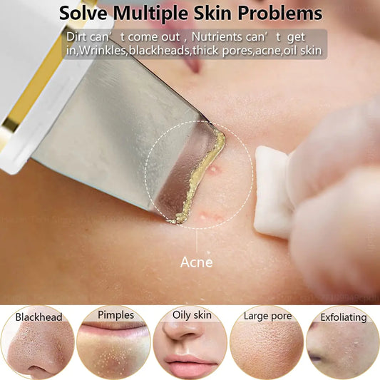 Ultrasonic Skin Scrubber: Facial Cleansing